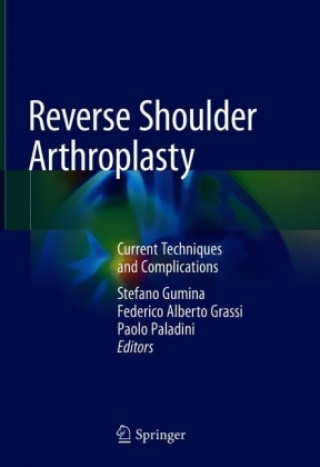 Reverse Shoulder Arthroplasty