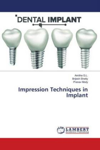 Impression Techniques in Implant