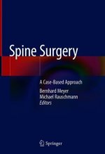 Spine Surgery