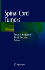 Spinal Cord Tumors
