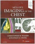 Muller's Imaging of the Chest