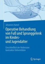 Operative Behandlung von Fu und Sprunggelenk im Kindes- und Jugendalter