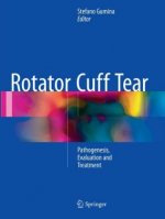 Rotator Cuff Tear