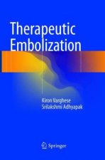 Therapeutic Embolization