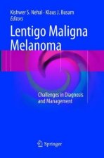 Lentigo Maligna Melanoma