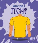 Why Do I Itch?