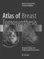 Atlas of Breast Tomosynthesis