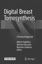 Digital Breast Tomosynthesis