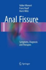 Anal Fissure