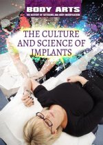 The Culture and Science of Implants