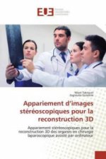 Appariement d'images stéréoscopiques pour la reconstruction 3D