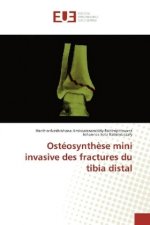 Ostéosynth?se mini invasive des fractures du tibia distal