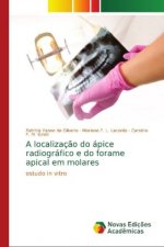 localizacao do apice radiografico e do forame apical em molares