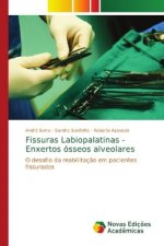Fissuras Labiopalatinas - Enxertos osseos alveolares