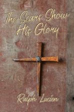 Scars Show His Glory