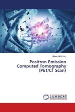 Positron Emission Computed Tomography (PET/CT Scan)