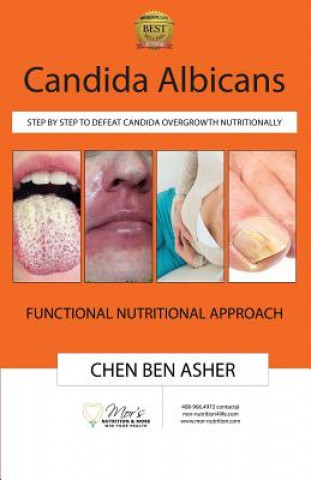 Candida Albicans: Step by Step to Defeat Candida Overgrowth Nutritionally