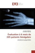Évaluation à 6 mois de 205 patients Sénégalais