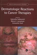 Dermatologic Reactions to Cancer Therapies