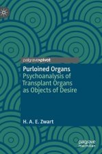 Purloined Organs