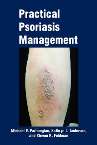Practical Psoriasis Management