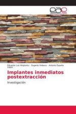 Implantes inmediatos postextracción