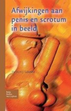Afwijkingen aan penis en scrotum in beeld