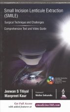 Small Incision Lenticule Extraction (SMILE): Surgical Technique and Challenges