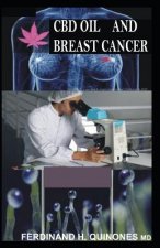 CBD Oil and Breast Cancer: Ultimate Guide on Using CBD Oil to Treat Breast Cancer