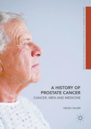 History of Prostate Cancer