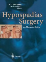 Hypospadias Surgery