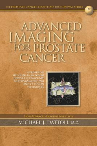 Advanced Imaging for Prostate Cancer: A Primer on 3D Color-Flow Power Doppler Ultrasound, Multiparametric MRI and CT Fusion Techniques