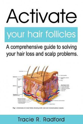Activate Your Hair Follicles: A Comprehensive Guide to Solving Your Hair Loss and Scalp Problems
