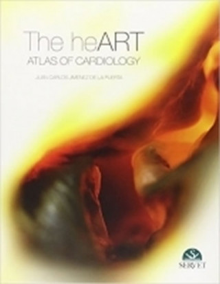 HEART ATLAS OF CARDIOLOGY