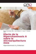 Efecto de la Hipervitaminosis A sobre la microarquitectura ósea