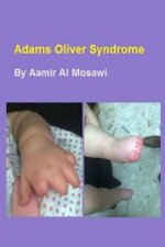 Adams Oliver syndrome: Clinical genetics