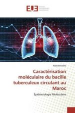 Caracterisation moleculaire du bacille tuberculeux circulant au Maroc