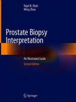 Prostate Biopsy Interpretation