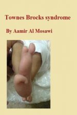 Townes Brocks syndrome: Clinical genetics