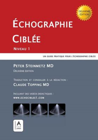 Echographie Ciblee