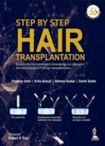 Step by Step Hair Transplantation