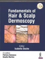 Fundamentals of Hair and Scalp Dermoscopy