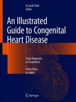 Illustrated Guide to Congenital Heart Disease