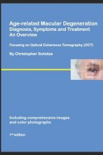 Age-related Macular Degeneration, Diagnosis, Symptoms and Treatment, An Overview: Focusing on Optical Coherence Tomography