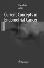 Current Concepts in Endometrial Cancer