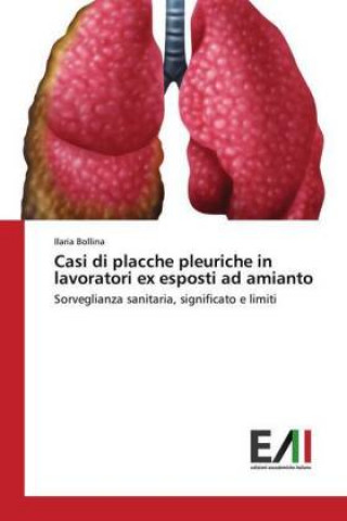 Casi di placche pleuriche in lavoratori ex esposti ad amianto