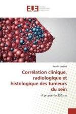 Correlation clinique, radiologique et histologique des tumeurs du sein