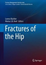 Fractures of the Hip