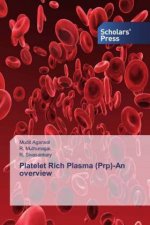 Platelet Rich Plasma (Prp)-An overview