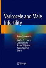 Varicocele and Male Infertility